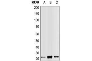 Western blot analysis of RAB14 expression in Jurkat (A), Raw264. (RAB14 Antikörper  (C-Term))