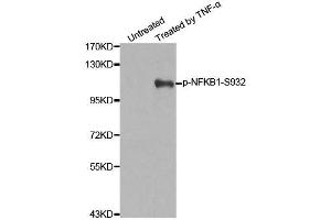 Western blot analysis of extracts from 293 cells untreated or treated with TNF-a using Phospho-NFKB1-S932 antibody (ABIN2988211). (NFKB1 Antikörper  (pSer932))