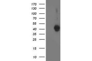 Western Blotting (WB) image for anti-Leucine Carboxyl Methyltransferase 1 (LCMT1) antibody (ABIN1499106) (LCMT1 Antikörper)