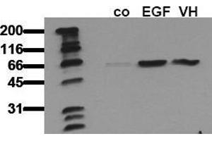 Western Blotting (WB) image for anti-V-Akt Murine Thymoma Viral Oncogene Homolog 1 (AKT1) (pSer473) antibody (ABIN126853) (AKT1 Antikörper  (pSer473))