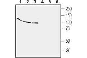 Western blot analysis of human  monocytic leukemia cell line lysate (lanes 1 and 4), human Jurkat T-cell leukemia cell line lysate (lanes 2 and 5) and human  breast adenocarcinoma cell line lysate (lanes 3 and 6):1-3. (EPH Receptor B4 (EPHB4) Peptid)
