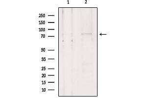 Western blot analysis of extracts from Hela, using SLCO1A2 Antibody. (SLCO1A2 Antikörper  (Internal Region))