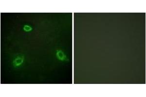 Immunofluorescence analysis of HepG2 cells, using TM16G Antibody. (Anoctamin 7 Antikörper  (AA 881-930))