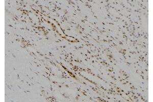 ABIN6256832 and ABIN6273678 at 1/100 staining Human kidney tissue by IHC-P. (KDM5D Antikörper  (C-Term))