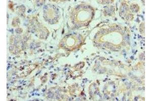 Immunohistochemistry of paraffin-embedded human salivary gland tissue using ABIN7145996 at dilution of 1:100 (CCL28 Antikörper  (AA 20-127))