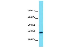 Host: Rabbit Target Name: SOD1 Sample Type: Placenta lysates Antibody Dilution: 1. (SOD1 Antikörper  (C-Term))