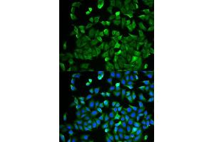 Immunofluorescence analysis of HeLa cells using NF2 antibody. (Merlin Antikörper  (AA 19-595))