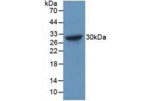 Detection of Recombinant CHGB, Human using Polyclonal Antibody to Chromogranin B (CHGB) (CHGB Antikörper  (AA 496-669))