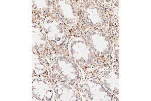 Immunohistochemical analysis of paraffin-embedded human colon tissue using (ABIN389185 and ABIN2839348) performed on the Leica® BOND RXm.
