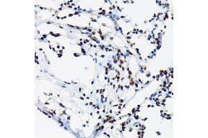 Immunohistochemistry of paraffin-embedded rat lung using Phospho-c-Jun-T91 Rabbit pAb (ABIN7268058) at dilution of 1:50 (40x lens). (C-JUN Antikörper  (pThr91))