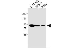 All lanes :PLOD1 Antibody (N-term) at 1:1000 dilution Lane 1: U-87 MG whole cell lysate Lane 2: MCF-7 whole cell lysate Lane 3: K562 whole cell lysate Lysates/proteins at 20 μg per lane. (PLOD1 Antikörper  (N-Term))