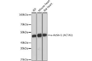 Western blot analysis of extracts of various cell lines, using α-Actin-1  Rabbit mAb (ABIN1682816, ABIN7101454, ABIN7101455 and ABIN7101456) at 1:1000 dilution. (Actin (Alpha-Actin) Antikörper)