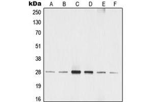 Western blot analysis of 14-3-3 zeta (pS58) expression in MCF7 (A), A549 (B), SP2/0 (C), rat liver (D), NIH3T3 (E), A431 (F) whole cell lysates. (14-3-3 zeta Antikörper  (pSer58))