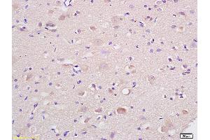 Formalin-fixed and paraffin embedded rat brain labeled with Anti-HSP75/TRAP1 Polyclonal Antibody, Unconjugated (ABIN686647) at 1:200 followed by conjugation to the secondary antibody and DAB staining. (TRAP1 Antikörper  (AA 501-650))