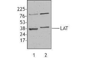 Western Blotting (WB) image for anti-Linker For Activation of T Cells (LAT) antibody (ABIN2666055) (LAT Antikörper)
