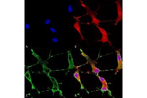 Immunocytochemistry/Immunofluorescence analysis using Mouse Anti-SHANK1 Monoclonal Antibody, Clone S22-21 (ABIN2483708).