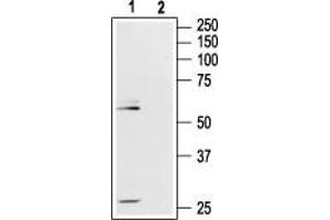 Western blot analysis of rat hippocampus lysate: - 1. (Mu Opioid Receptor 1 Antikörper  (Extracellular, N-Term))