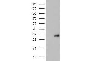 Western Blotting (WB) image for anti-Proteasome (Prosome, Macropain) Subunit, beta Type, 4 (PSMB4) antibody (ABIN1500474) (PSMB4 Antikörper)