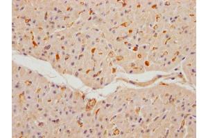 IHC image of ABIN7152923 diluted at 1:100 and staining in paraffin-embedded human heart tissue performed on a Leica BondTM system.