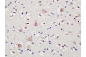 Formalin-fixed and paraffin embedded rat brain labeled with Rabbit Anti-NTR3 Polyclonal Antibody, Unconjugated (ABIN872315) at 1:200 followed by conjugation to the secondary antibody and DAB staining (Sortilin 1 Antikörper  (AA 731-831))