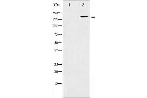 Western blot analysis of HER2 phosphorylation expression in EGF treated SK-OV3 whole cell lysates,The lane on the left is treated with the antigen-specific peptide. (ErbB2/Her2 Antikörper  (pTyr1248))