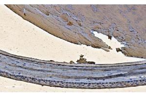 IHC analysis of Alpha B Crystallin/CRYAB using anti-Alpha B Crystallin/CRYAB antibody (ABIN7601209). (CRYAB Antikörper  (AA 30-151))