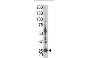 Antibody is used in Western blot to detect AK5 in mouse liver tissue lysate.