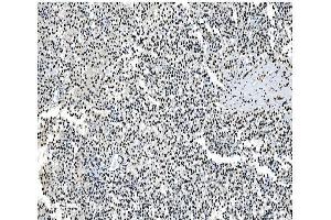 IHC analysis of NRF1 using anti- NRF1 antibody (ABIN7600874). (NRF1 Antikörper  (AA 246-503))