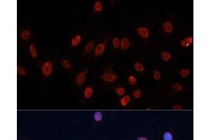 Immunofluorescence analysis of C6 cells using HNRNPU Polyclonal Antibody at dilution of 1:100. (HNRNPU Antikörper)