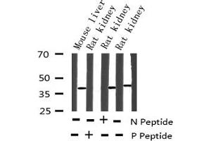 Western blot analysis of Phospho-AMPK β1(Ser181) expression in various lysates (PRKAB1 Antikörper  (pSer181))