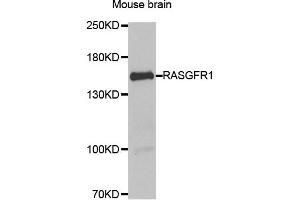 Western blot analysis of extract of Mouse brain, using RASGRF1 antibody.