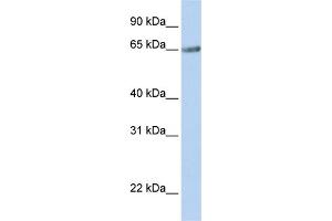 WB Suggested Anti-TM9SF1 Antibody Titration:  0. (TM9SF1 Antikörper  (N-Term))