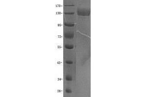 Validation with Western Blot