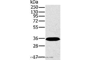 Western blot analysis of Mouse brain tissue, using PPP2CA Polyclonal Antibody at dilution of 1:450 (PPP2CA Antikörper)
