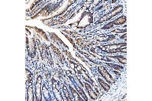 IHC analysis of SNRNP200 using anti-SNRNP200 antibody (ABIN7602032). (SNRNP200 Antikörper  (AA 557-2129))