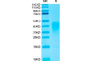 SDS-PAGE (SDS) image for Interleukin 13 (IL13) (AA 21-132) protein (His-Avi Tag,Biotin) (ABIN7274901)