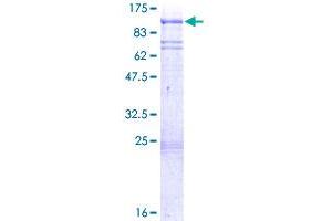 Image no. 1 for Polo-Like Kinase 2 (PLK2) (AA 1-685) protein (GST tag) (ABIN1315436) (PLK2 Protein (AA 1-685) (GST tag))