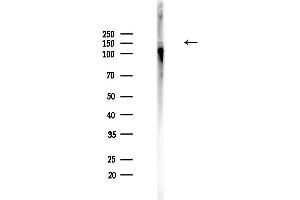 Western blot analysis of lysates from Hela cells(heat-shock,45 min treatment), using Phospho-ASK1 (Ser1033) Antibody at 1/1000 dilution.