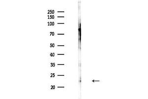 anti-Proteinase 3 (PRTN3) (Internal Region) antibody