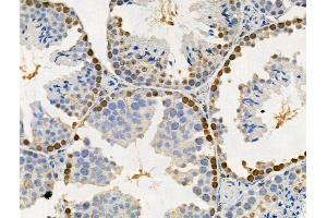 Phospho-SAMHD1 (Thr592) Antibody at 1/100 staining Mouse testis tissue by IHC-P. (SAMHD1 Antikörper  (pThr592))