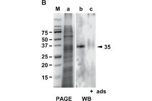 Western Blot analysis of ABIN125786 specificity. (Galectin 2 Antikörper)