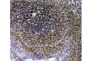 anti-Interleukin 16 (IL16) (AA 1205-1322) antibody