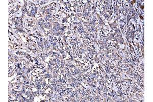 IHC analysis of IMPDH1 using anti-IMPDH1 antibody (ABIN7599864). (IMPDH1 Antikörper  (AA 123-500))