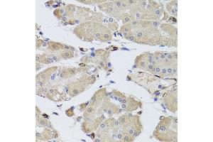 Immunohistochemistry of paraffin-embedded human stomach using FABP5 antibody at dilution of 1:100 (x40 lens).