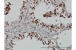 Immunoperoxidase of monoclonal antibody to SMG1 on formalin-fixed paraffin-embedded human testis. (SMG1 Antikörper  (AA 2922-3031))