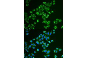 Immunofluorescence analysis of HeLa cells using TAGLN antibody (ABIN5974090). (Transgelin Antikörper)