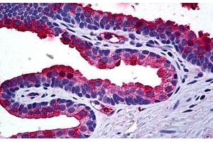 Human Prostate: Formalin-Fixed, Paraffin-Embedded (FFPE) (TIMP2 Antikörper  (AA 27-221))