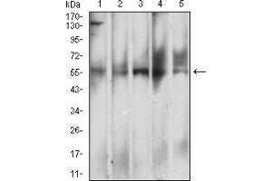 Western Blotting (WB) image for anti-C-Type Lectin Domain Family 4, Member M (CLEC4M) (AA 237-399) antibody (ABIN7193339)