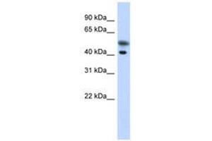 Image no. 1 for anti-Tropomodulin 2 (TMOD2) (N-Term) antibody (ABIN6741280) (TMOD2 Antikörper  (N-Term))