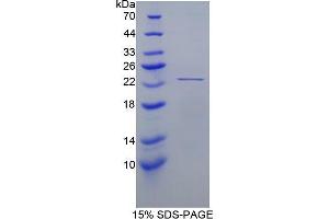 SDS-PAGE (SDS) image for Peroxiredoxin 1 (PRDX1) (AA 1-199) protein (His tag) (ABIN1099366)